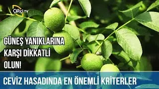 Güneş Yanıklarına Karşı Dikkatli Olun! -ÇETİN CEVİZ