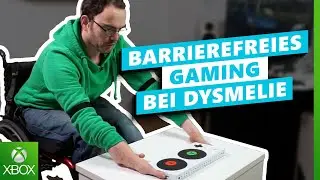Tipps zum Gaming Set-Up bei Dysmelie