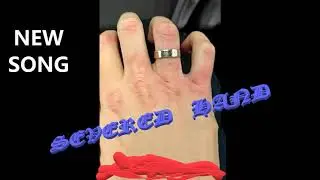Severed Hand