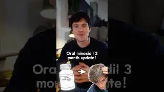 Обновление за 3 месяца приема миноксидила внутрь! 🚨