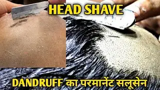 How to Anti Dandruff Ultimate  Head Shave At Barber Shop | Parmanent Dandruff Salusan  A Barber