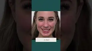 Cheek Filler Benefits | Why Get It? | Before & After | Viva Day Spa + Med Spa