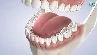 Tooth Restoration Options at Oral Surgery Hawaii in Honolulu, HI