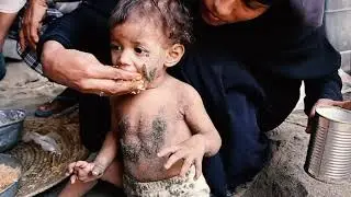 When War Hits, Hunger Strikes Harder