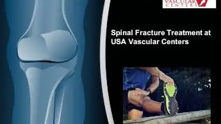 Spinal Fracture Treatment in California - USA Vascular Centers