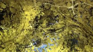 Mind Illuminated - Greg Dunn M&uuml;tter Museum Exhibition