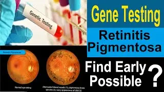 Gene Testing for Eye Problem || Can find  RP Early ? || How they Test the Gene?