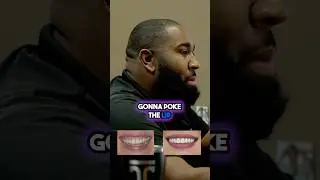 Will Veneers Really Change Your Face Shape Forever?