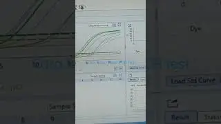 Reading result of PCR test