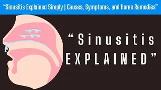 &ldquo;Sinusitis - Penjelasan 📌 | Penyebab, Gejala, dan Pengobatan Rumahan Sinus&rdquo;