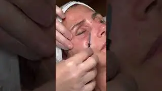Tratamiento Tesla Med