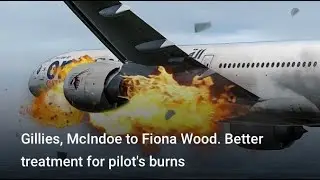 Pilot's burns. No more 