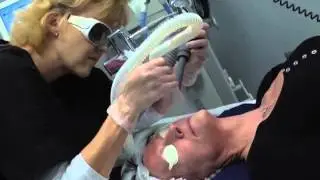 Profractional Laser Skin Resurfacing with Dallas OBGYN Dr. Carol Norton