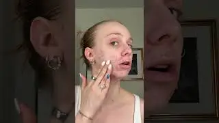 . @beautyofjoseon_official  is that girl #acne #tintedsunscreen