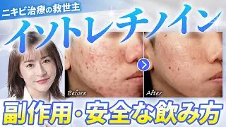 【ニキビ治療の最後の砦】危険な副作用が！？イソトレチノインを使う前に絶対に知るべきこと【肌育/ニキビ/症例解説】
