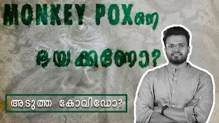 മങ്കി പോക്സ് : അറിയേണ്ടതെല്ലാം ? അടുത്ത കോവിഡോ? - MONKEY POX