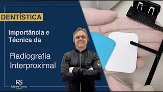 Radiografia interproximal.