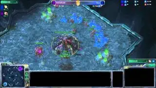 FXO Sheth vs VT Azz - 1 / 5