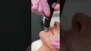 Skin feeling parched? Try Hydrafacial