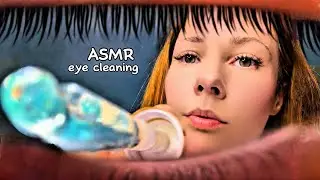 ASMR Eye Cleaning 👁️ Wet Mouth Sounds For Deep Sleep & Relaxation (Intense Tingles)