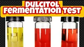 Dulcitol fermentation test: biochemical test lecture 14