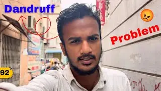 Getting rid of dandruff | head ech ra babu 😕