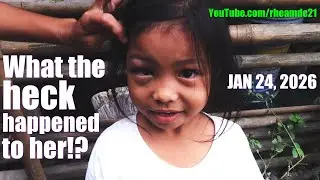 What the Heck Happened to Her Eye? Giving Joy to Filipino Families Since 2006. Help in Philippines!