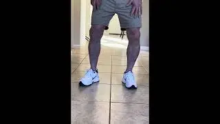 9-Month Recovery status Right TKA Partial Revision