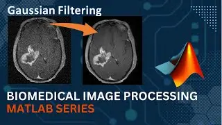 Gaussian Filter || MATLAB Code Implementation || Medical Image Processing | Computer Vision