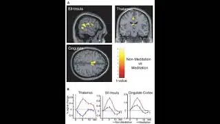 Art of living and meditation impact on Anterior Cingulate Cortex 4