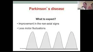 Renato Munhoz - Patient Selection and Eligibility for DBS in Parkinsons disease
