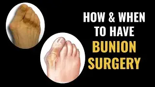 Bunions - Dr. Donald Pelto - Worcester Podiatrist