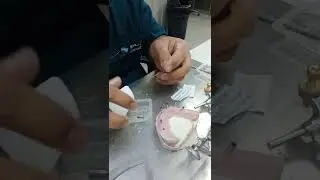 putting temporary Abutment non engaging conical connection NP and RP
