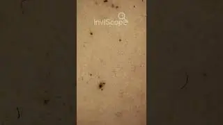 You&rsquo;ll NEVER Use a Makeup Sponge Again After Seeing THIS #Microscope #Shorts #Makeup