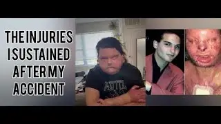 All about my life, my car, accident, and my transplant | Joe Dimeo | In my own words