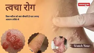 A step by step guide to diagnose skin diseases.