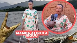 ITAKULIZA BINTI ALILIWA MGUU NA MAMBA MTONI RUAHA SASA ANATEMBEA KWA MGUU MMOJA