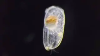 Ostracoda