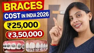 Braces cost in india | Braces cost 2026 | Types of braces | #bracescost #braces #bracesupdate