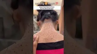 dark neck cream | dark neck treatment |