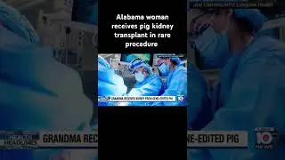 Alabama woman receives pig kidney transplant in rare procedure #health #transplant