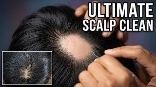 ASMR Scalp Cleaning, Includes Scalp Scratching No Talking #MMO007