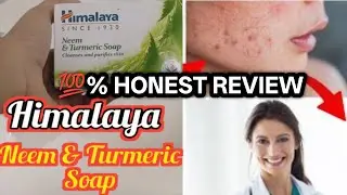 Himalaya Neem & Turmeric Soap Review || Soap review || 100% honest review ||
