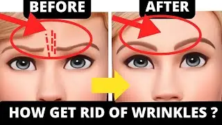 No Botox! Remove Frown Lines with Face Yoga in 14 Days Get Rid of Frown Lines in 2 Weeks