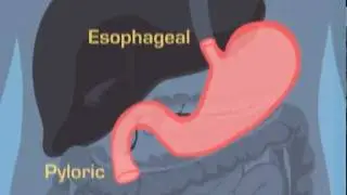 Art of Bleeding - ANATOMY MINUTES - The Stomach