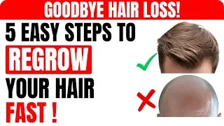 This 30 Day Routine REVERSES Hair Loss Naturally (No Rogaine, No Surgery) | Healthy Senior