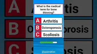 USA Quiz Challenge: Test Your Knowledge With This Question #usaquiz #funquiz #brainteaser #usafacts
