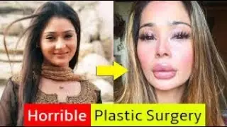 10 TV Actress Who Looks Horrible After Plastic Surgery   Unbelievable