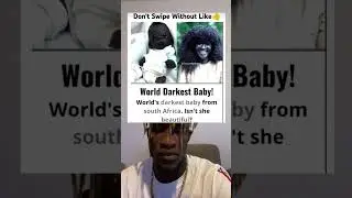 World&rsquo;s Darkest Baby..