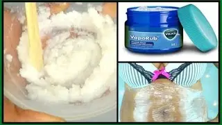 SURPRISING USE OF VICKS VAPORUB | MELTS  BELLY FAT WITH THIS FAT BURNING CREAM |Khichi Beauty